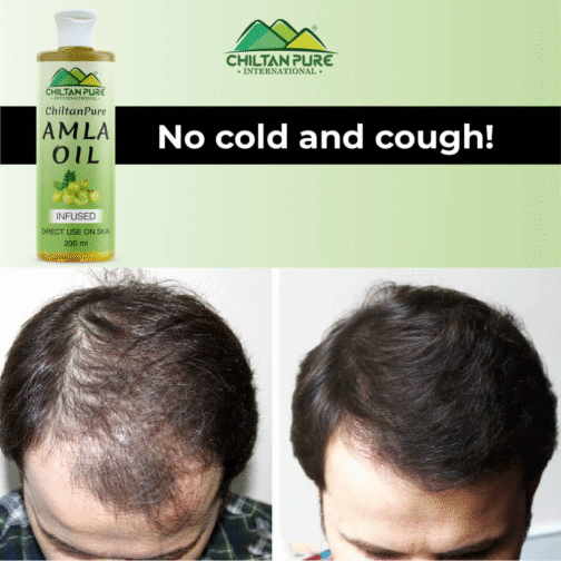 Chiltan Pure Amla Oil – Natural Hair Nourishment