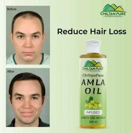 Chiltan Pure Amla Oil – Ultimate Hair Revitalizer for Stronger, Shinier Hair - Image 2